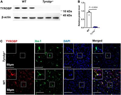 Downregulation of m6A Methyltransferase in the Hippocampus of Tyrobp–/– Mice and Implications for Learning and Memory Deficits